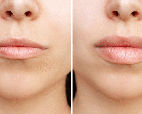 beforeafter10