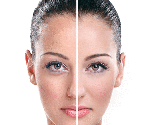 beforeafter3