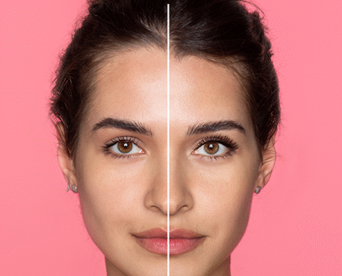 beforeafter4
