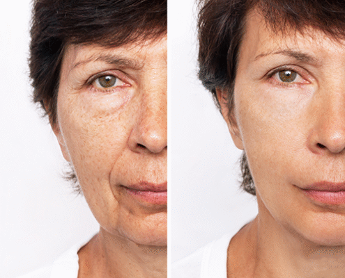 beforeafter7