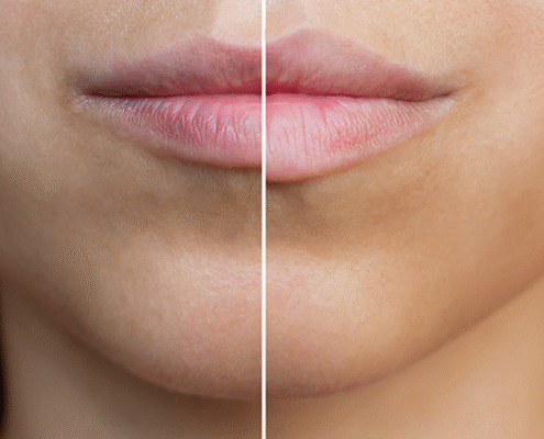 beforeafter9